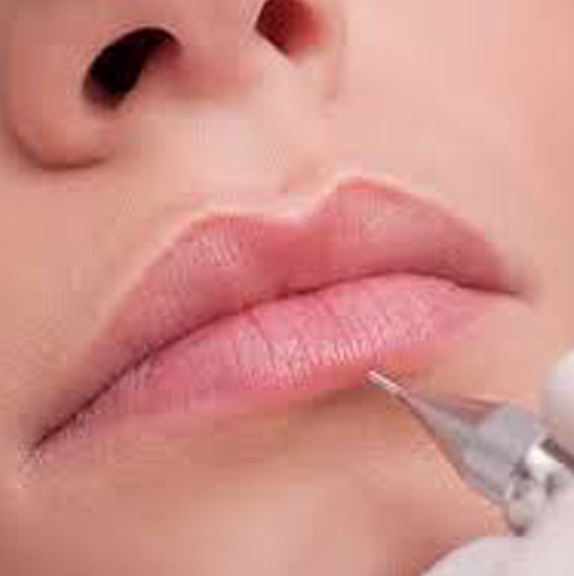 Electrolysis